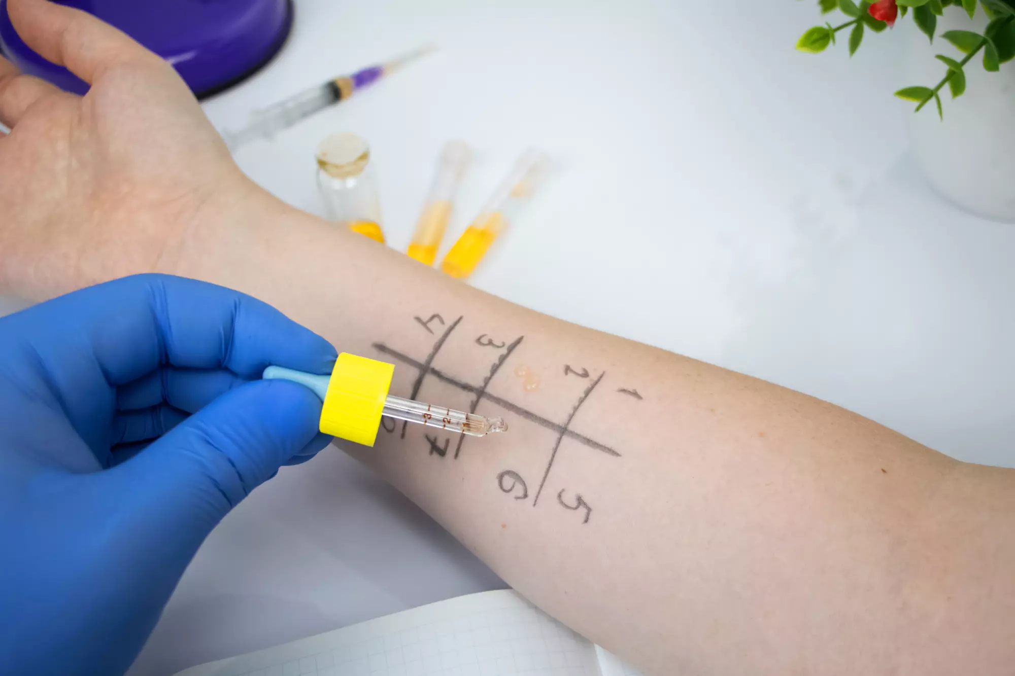 tests-allergologiques